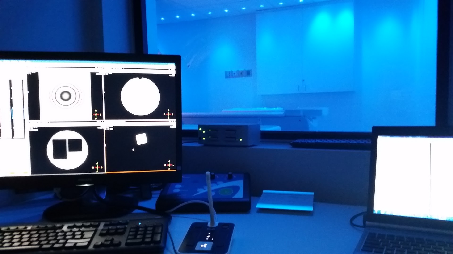 MRI operator console showing QA phantom images